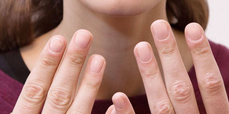 treatment-for-brittle-nails-how-to-strengthen-weak-and-brittle-nails