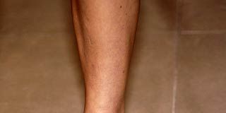 Human, Brown, Skin, Human leg, Joint, Toe, Style, Organ, Foot, Tan, 