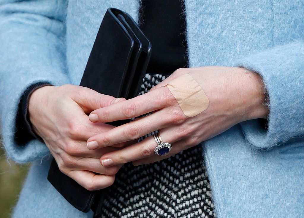 Kate Middleton e lo strano caso dei cerotti sulle dita
