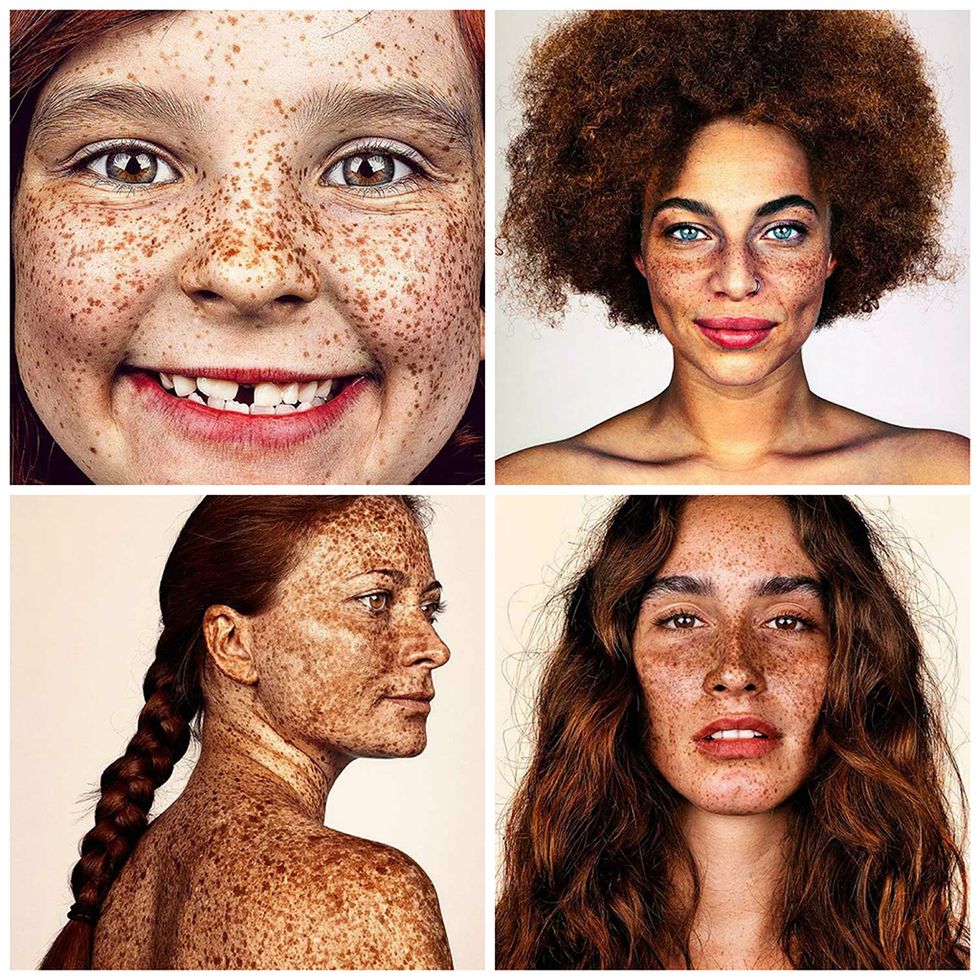 <p>Hay mujeres a las que no les gusta tener (tantas) pecas, pero <a href="https://www.instagram.com/mrelbank/" target="_blank">Brock Elbank</a> está dispuesto a hacer todo lo posible para mostrar su belleza. Está trabajando en una serie de fotografías de niñas y mujeres con pecas, para hacer una exposición el año que viene. “Siempre me han gustado las pecas, y lo que me parece interesante de sujetos que conozco y he tenido la suerte de fotografiar, es que en general, han tenido problemas en su infancia, o incluso adultez, por tener que vivir con ellas”, señala.</p>