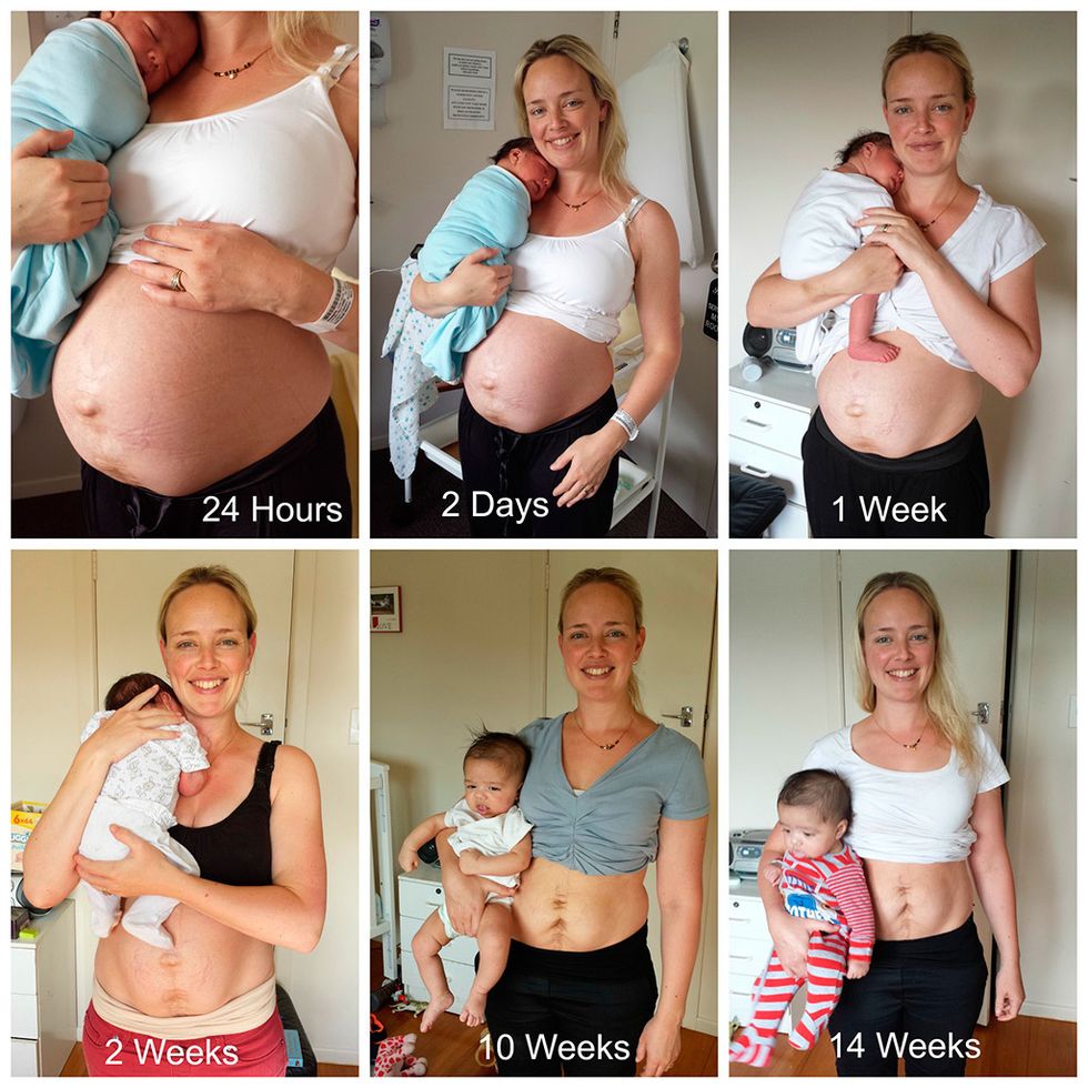 <p>La nutricionista neozelandesa&nbsp;<strong>Julie Bhosale</strong> <a href="http://juliebhosale.co.nz/my-real-postpartum-body/" target="_blank">documentó en su blog</a>&nbsp;la evolución de su cuerpo tras dar a luz a su segundo hijo: “Vivimos en una sociedad que nos bombardea con imágenes de mujeres que, tras dar a luz, simplemente han vuelto a tener el cuerpo que tenían. Me alegro por ellas, pero son una pequeña minoría. Para la mayoría de mujeres, nuestros cuerpos cambian, y mucho”, contó.</p>