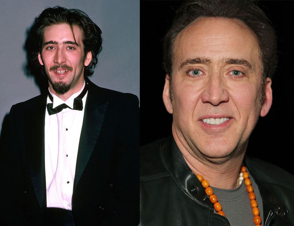 <p>El actor ha cambiado mucho desde su juventud. Su pelo y su dentadura totalmente renovada han sido los puntos fuertes físicos que forman parte del atractivo de <strong>Nicolas Cage</strong>.</p>
