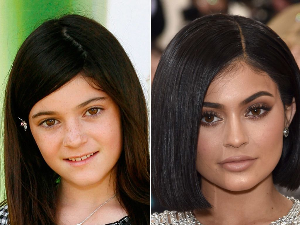 El antes y después de Kylie Jenner