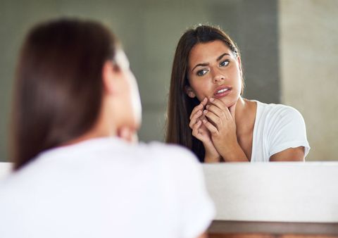 Creencias falsas sobre el acné, uno de los problemas estéticos que más afecta a las mujeres
