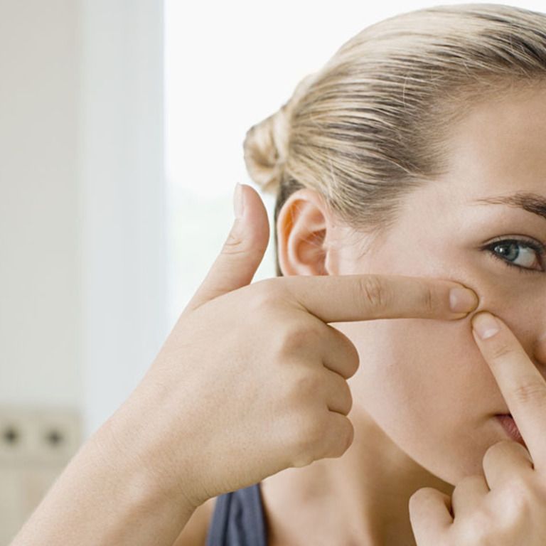 Come togliere i punti neri: rimedi efficaci per naso e viso