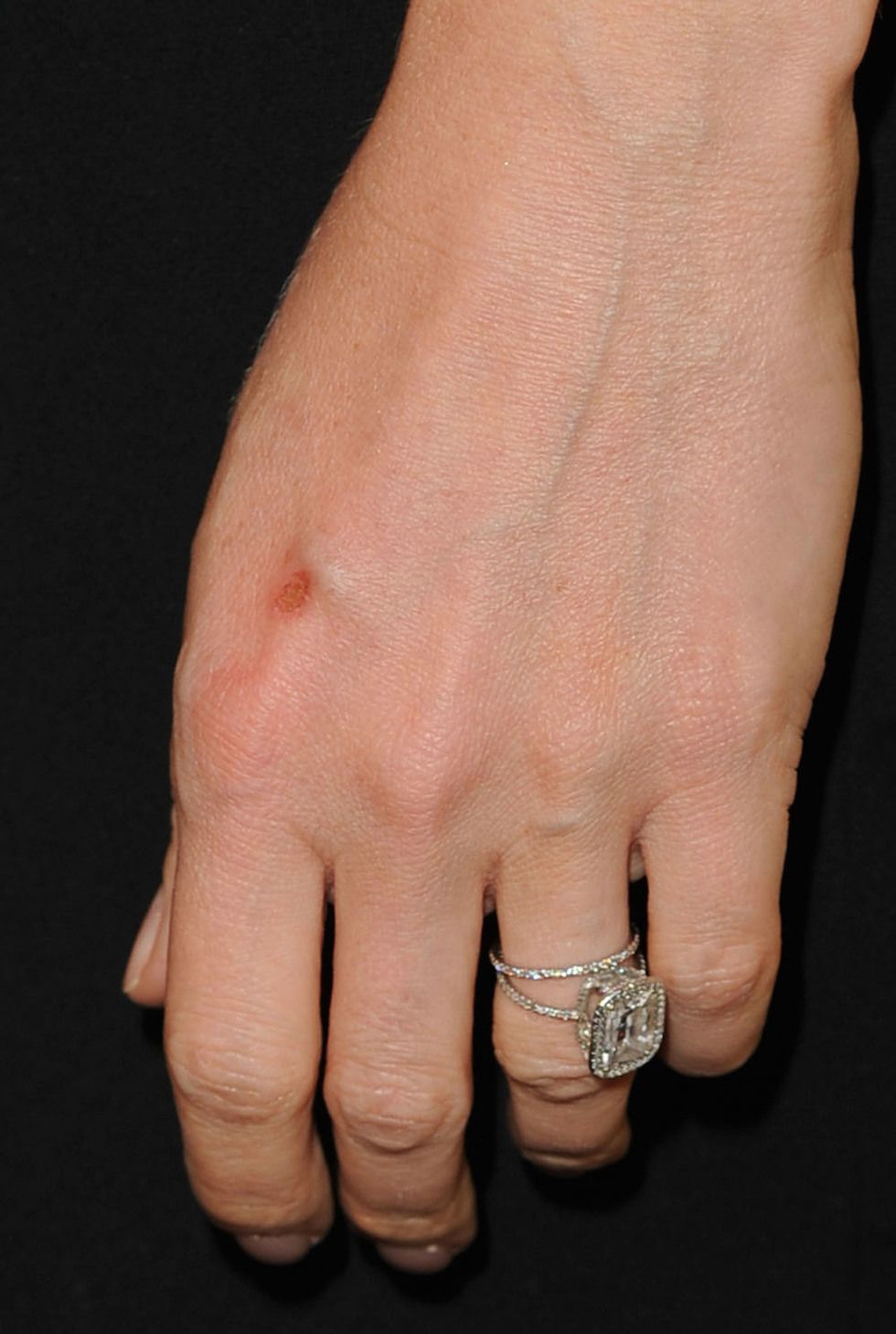 Finger, Skin, Jewellery, Wrist, Joint, Ring, Organ, Body jewelry, Pre-engagement ring, Engagement ring, 