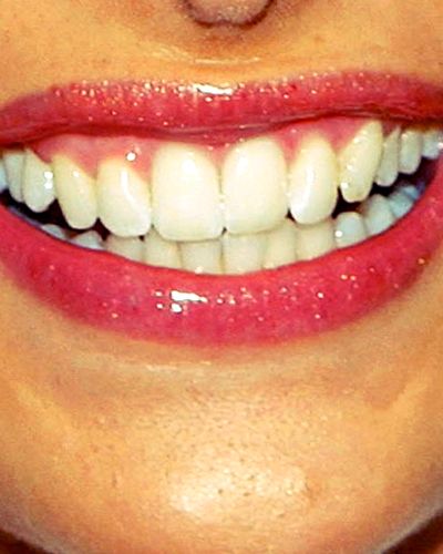 Mouth, Lip, Tooth, Skin, Facial expression, Jaw, Organ, Dentistry, Close-up, Laugh, 