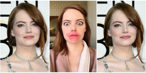 Tutte pazze per le maschere labbra (anche Emma Stone)