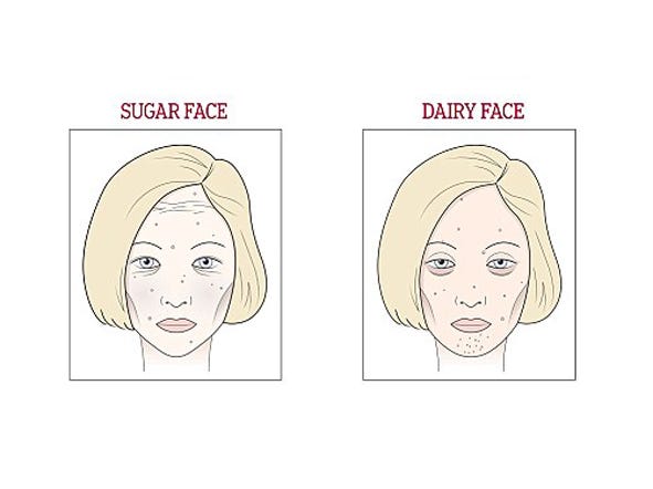 Do You Have Dairy Or Wine Face Here s What Could Be Causing Your Skin do-you-have-dairy-or-wine-face-here-s-what-could-be-causing-your-skin