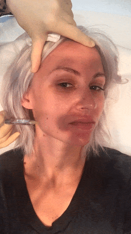 Lou Teasdale having mesotherapy injections