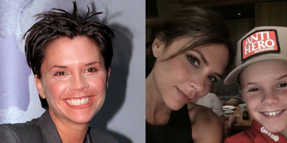 Victoria Beckham Eyebrows Before And After