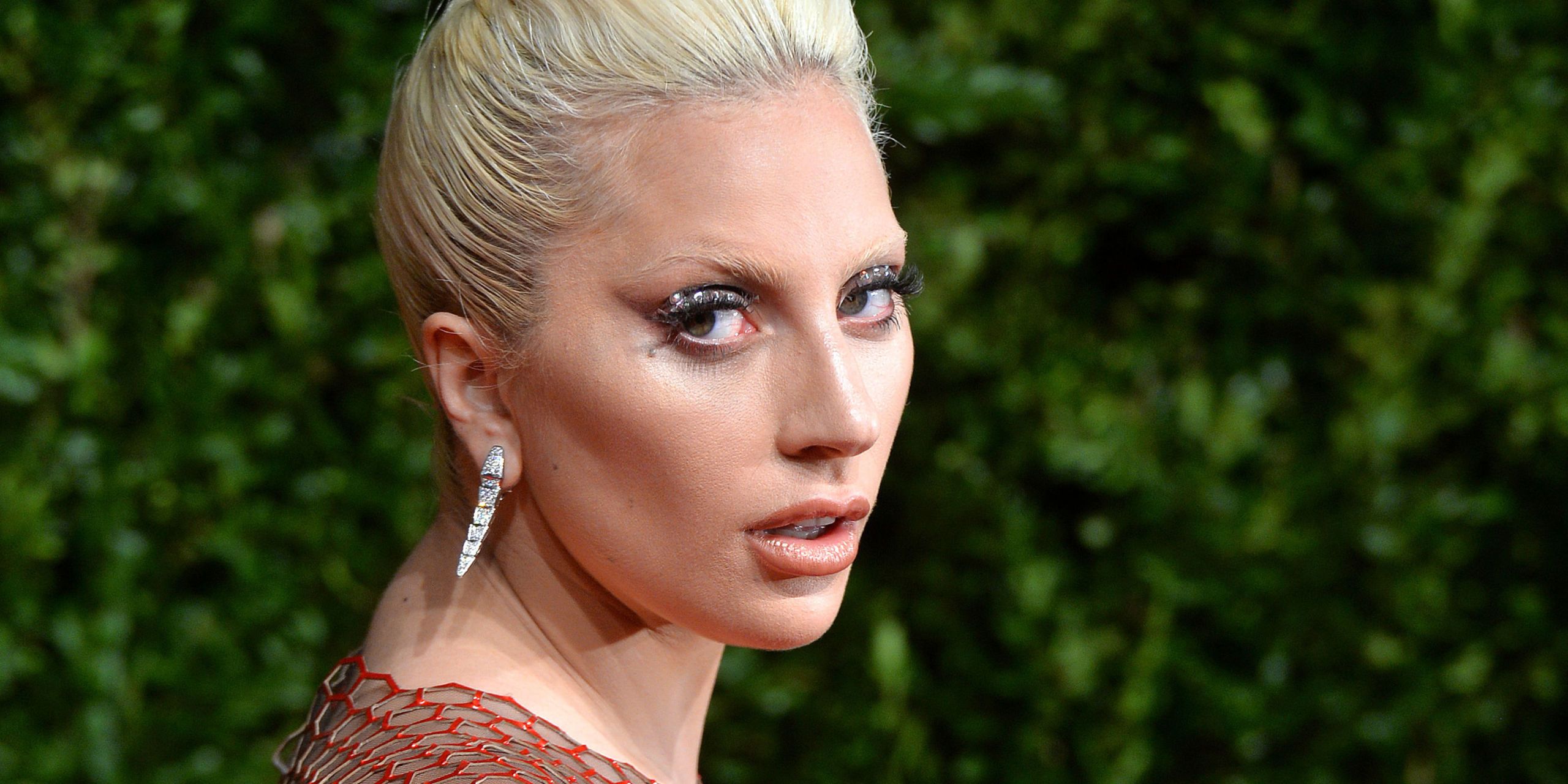 Lady Gaga Has Finally Revealed The Mystery Chronic Illness She Has Been ...