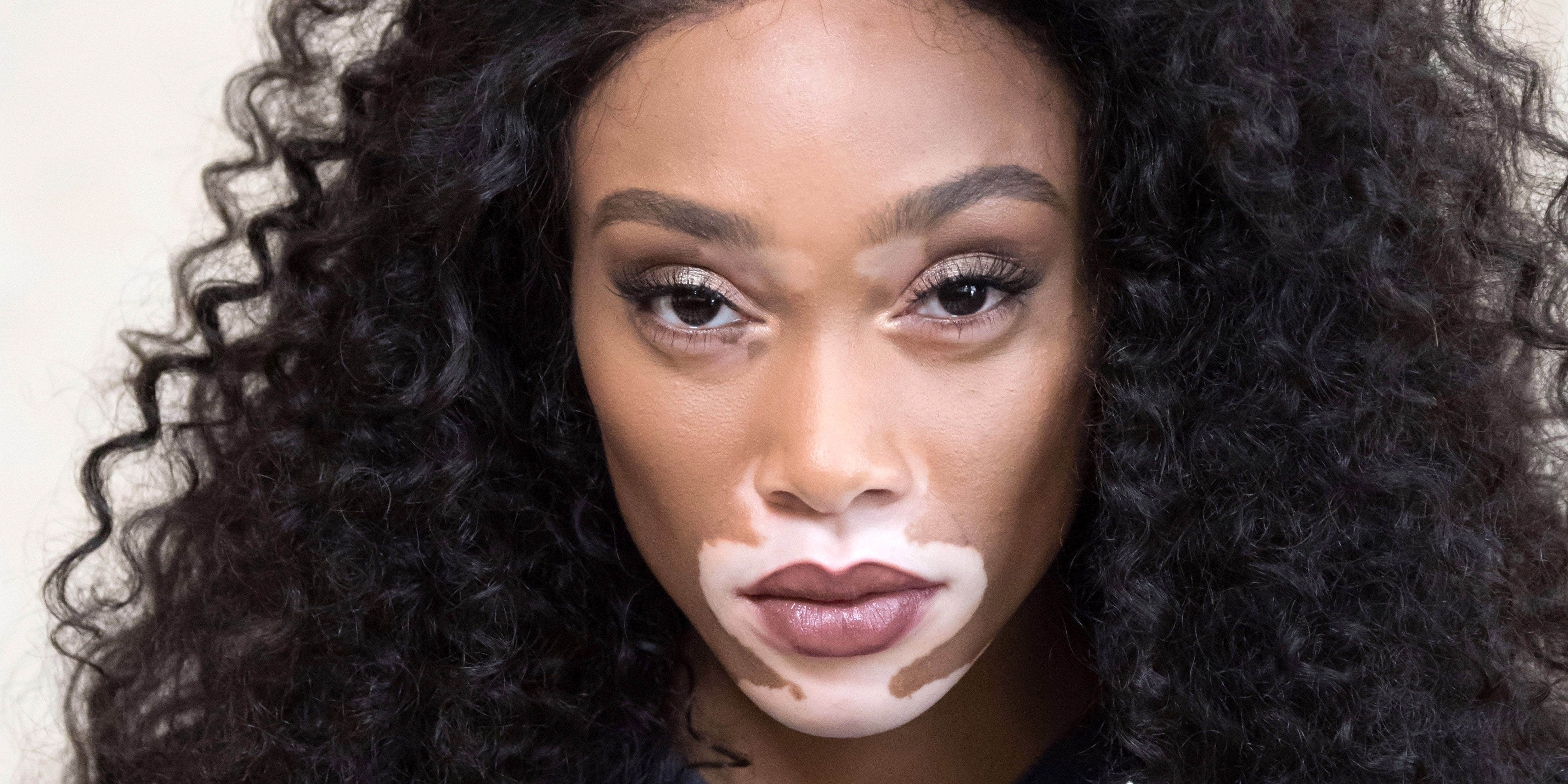 Pictures winnie harlow Winnie Harlow