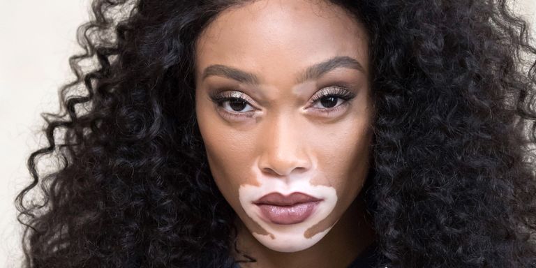 Real Talk With Winnie Harlow: Moods, Manuka, And The Mascara She Can't ...