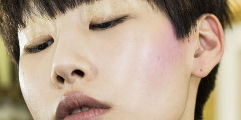 what is rosacea rosacea symptoms and treatments