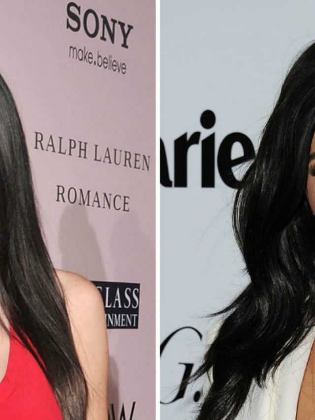 Kylie-Jenners-plastisch-chirurg-praat-voor-het-eerst-over-haar-enorme-metamorfose