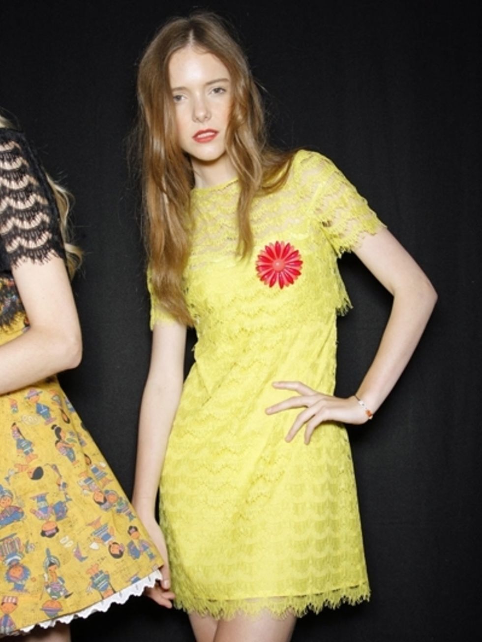 Clothing, Arm, Yellow, Dress, Shoulder, Textile, Joint, One-piece garment, Pattern, Cocktail dress, 