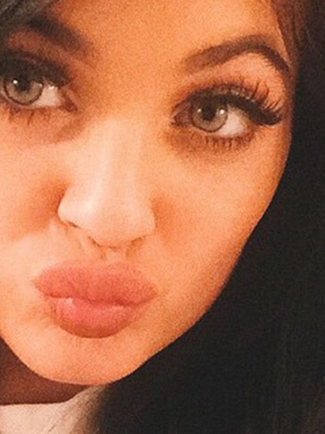 Kylie-Jenner-besteedt-iedere-dag-40-!-minuten-aan-haar-lippen