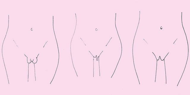 Los diferentes tipos de vulva.