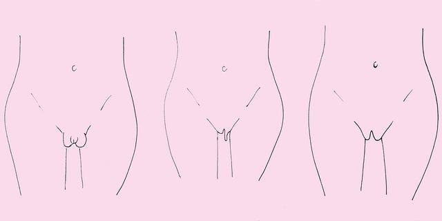 Los diferentes tipos de vulva.