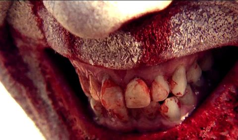 Tooth, Mouth, Jaw, Close-up, Organ, Flesh, Lip, Nose, Skin, Human body, 