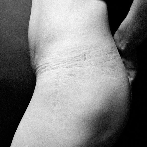 Skin, Joint, Monochrome, Monochrome photography, Black-and-white, Back, Ankle, Flesh, 