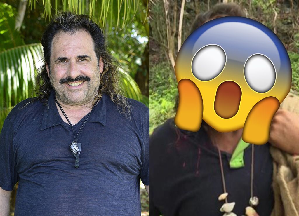 Ha ash antes y despues de adelgazar