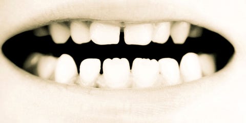 así serán nuestros dientes en el futuro