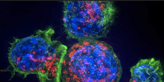 El cóctel que dispara al sistema inmune contra el cáncer