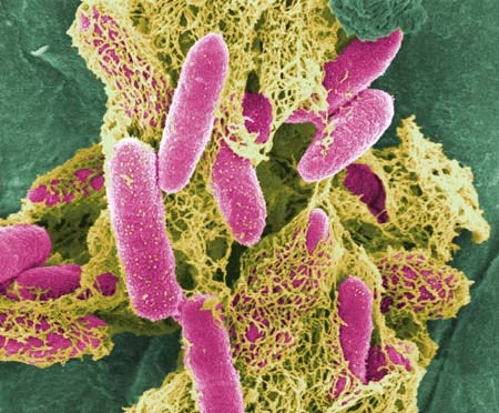 ¿Bacterias coliformes?