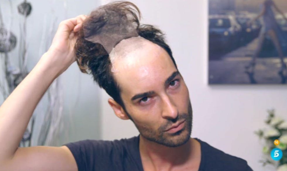 Cheek, Facial hair, Hairstyle, Skin, Chin, Forehead, Eyebrow, Jaw, Beard, Neck, 