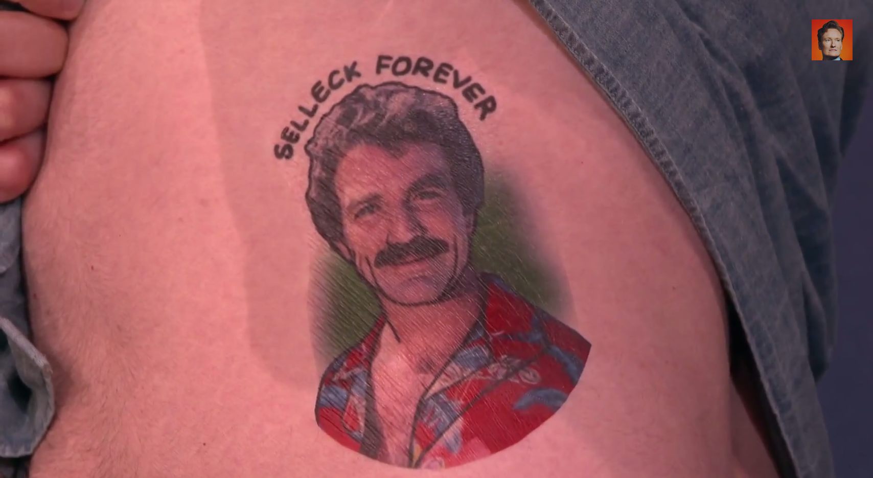 Rob mcelhenney tattoo removal