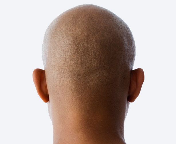 Balding Please Don T Get A Scalp Tattoo Male Actors Scalp