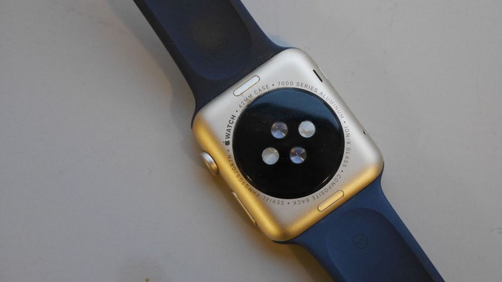 Apple Watch back and strap