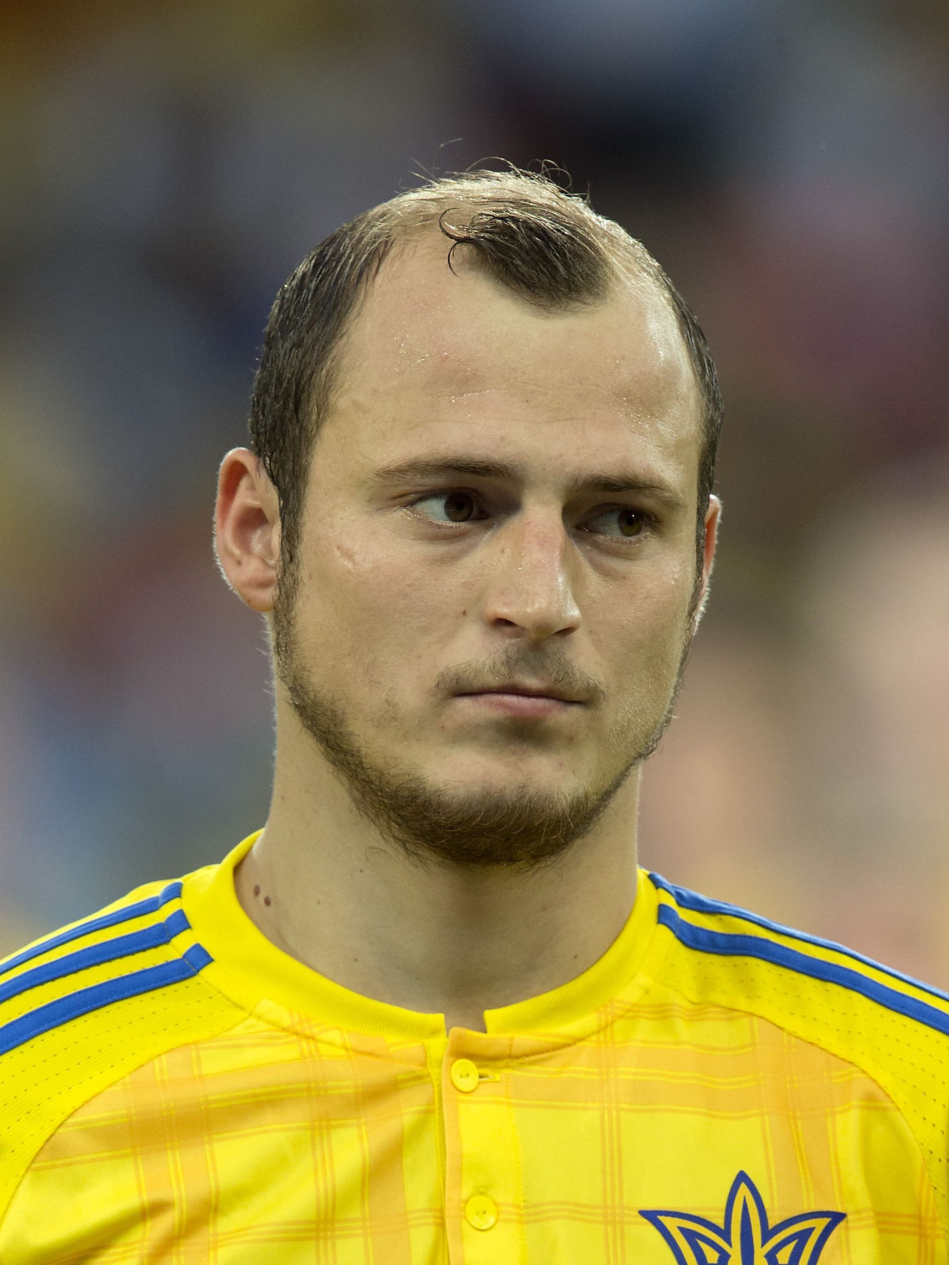 The 10 Worst Haircuts Of Euro 2016