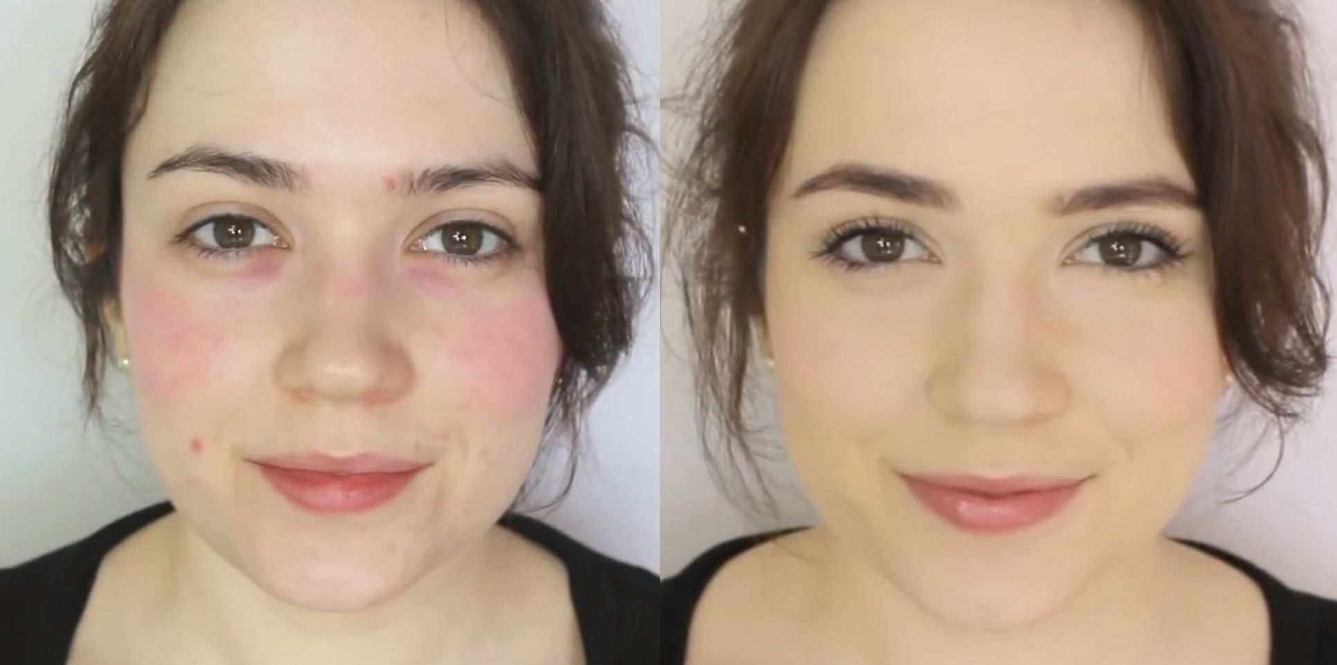 How To Cover Up Rosacea Makeup Tutorial For Concealing Redness