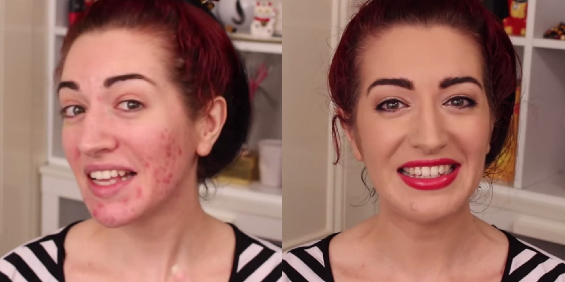 basic makeup tutorial for beginners with acne