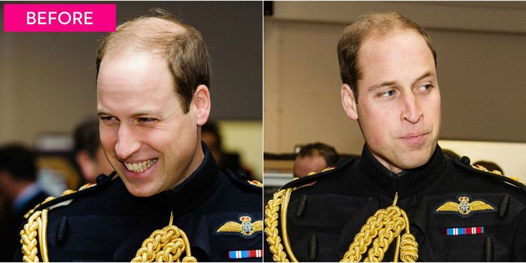 Prince William Gets Super Short Haircut — Prince William's ...