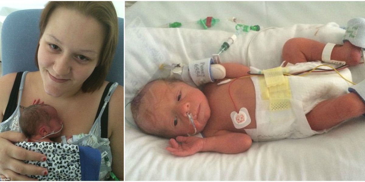 Doctors Perform C-Section After Woman Gave Birth - Amber Hughes C-Section