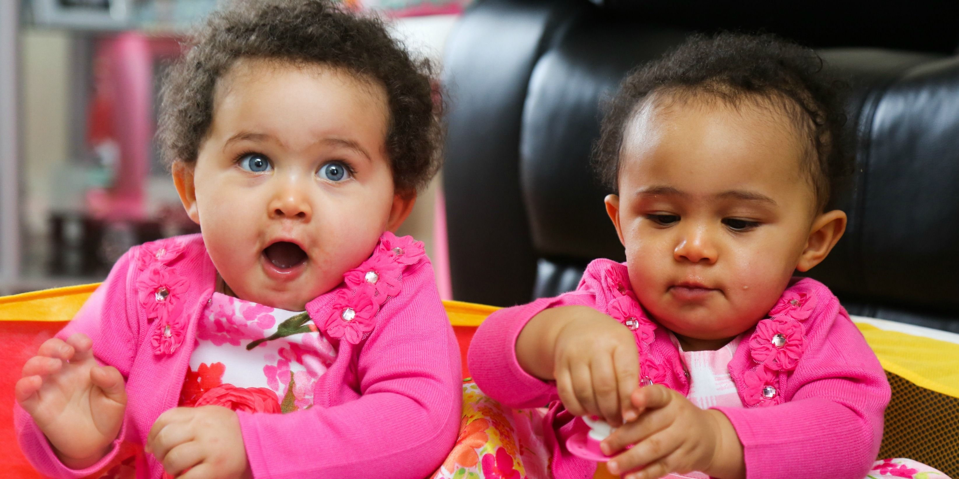 Mixed Race Twins Born With Identical Dna But Different Skin Colors