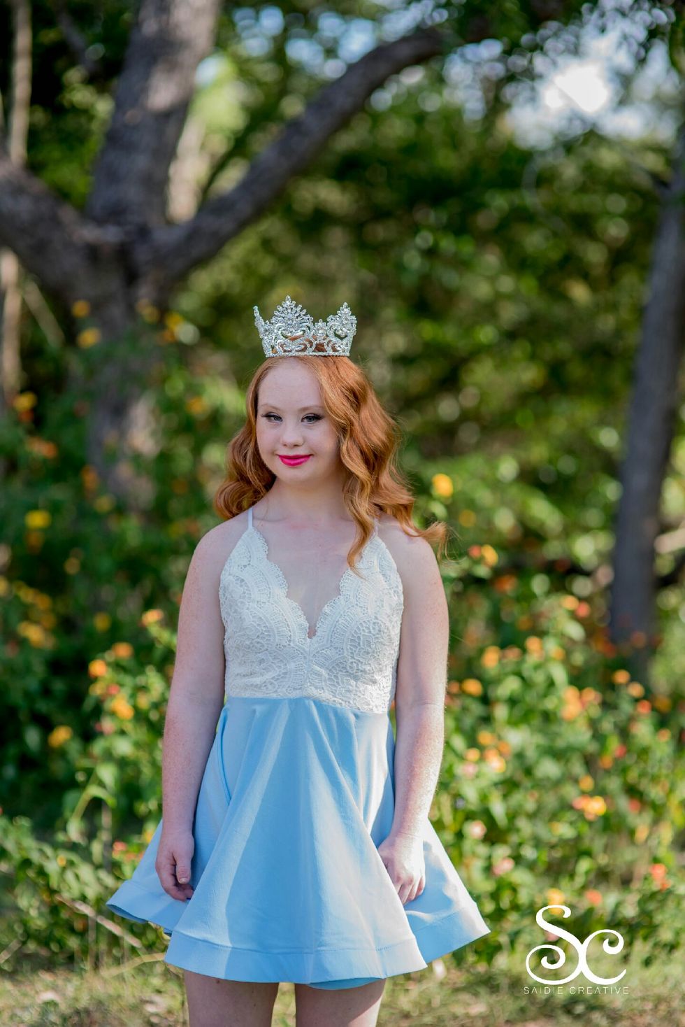 Madeline Stuart - Model With Down Syndrome's Summer Photo Shoot