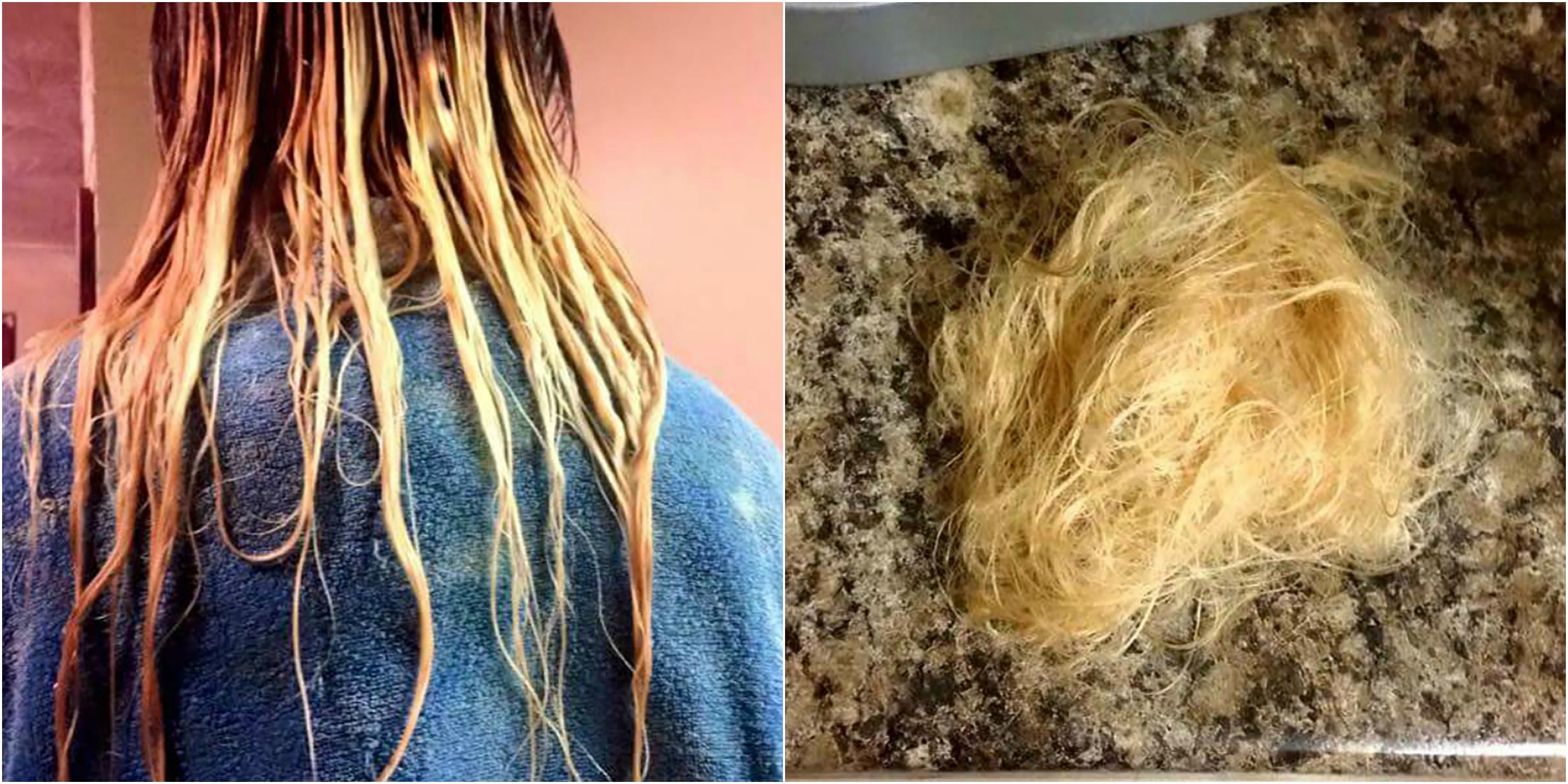 Teen S Hair Is Burnt Off After Trying To Diy Ombre Hair Color