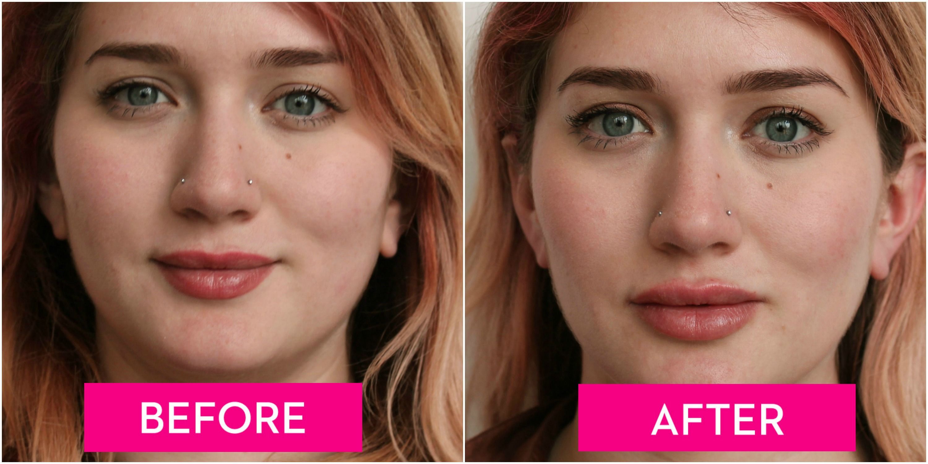 From How They to the Cost Injections, Lip Guide ... Feel A to