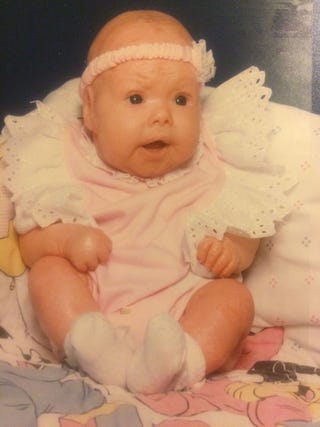 I M The First Mom With Harlequin Ichthyosis Stephanie Turner Essay I M The First Mom With Harlequin Ichthyosis Stephanie Turner Essay