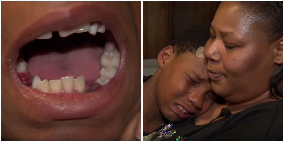 Baltimore School Extracts Student's Teeth - Maryland Mom Didn't Consent