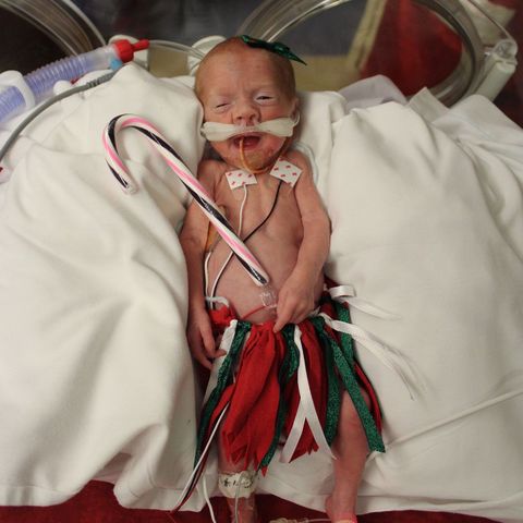 Our Daughter Was Born At 25 Weeks Our Premature Daughter S Journey