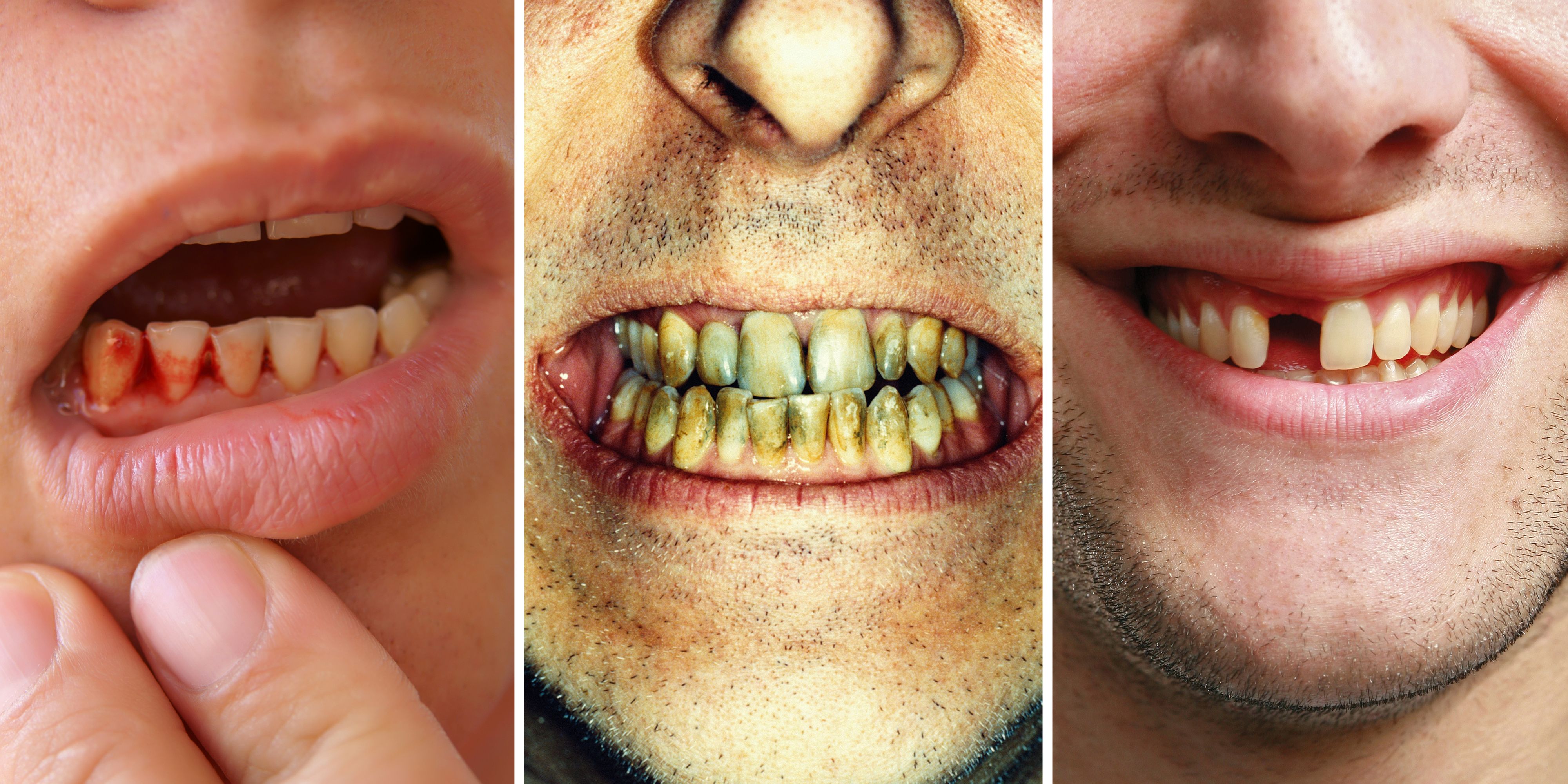 What Dental Problems Can Health About Teeth Tell ... - Your You