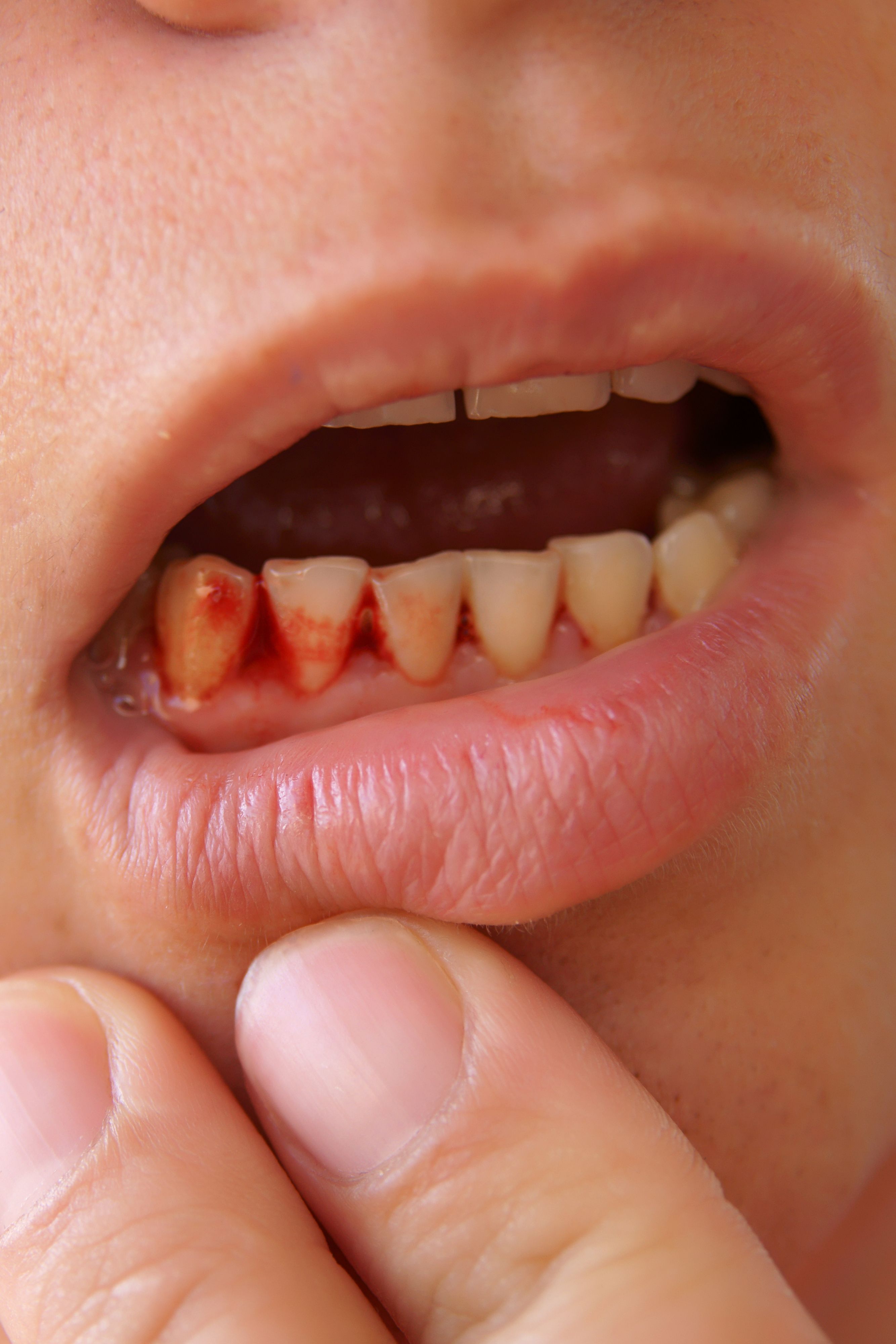 About Dental You Can Your ... Health - What Teeth Tell Problems