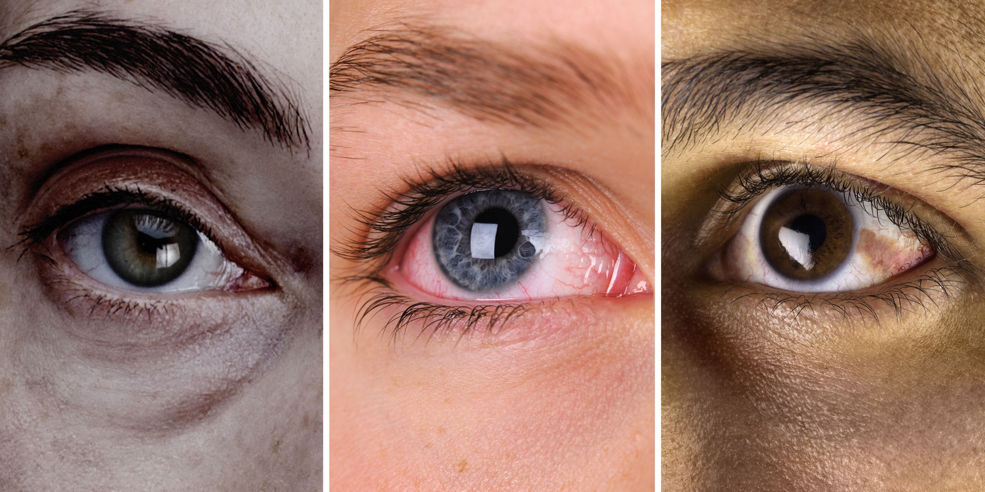 What Your Eyes Can Tell You About Your Health Eye Problems