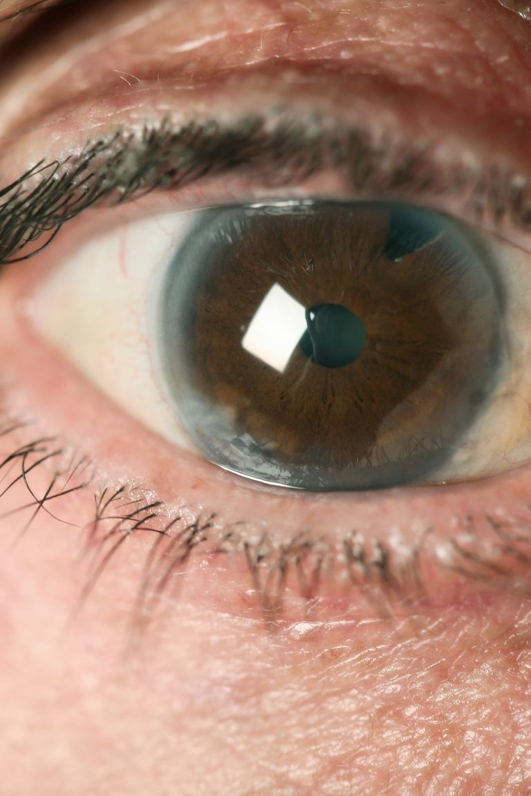 What Your Eyes Can Tell You About Your Health - Eye Problems